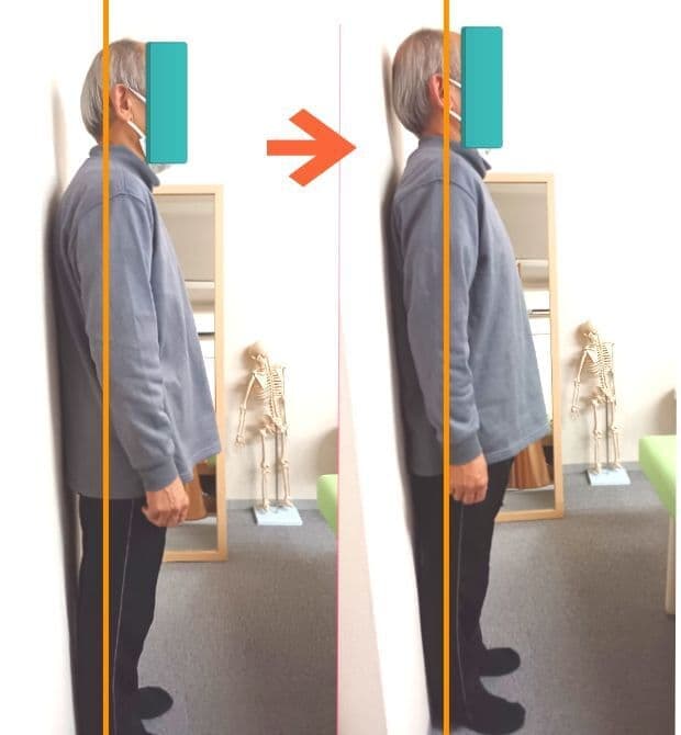 全身整体施術後